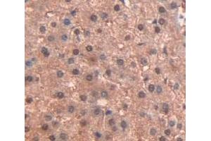 Figure. (PPARG 抗体  (AA 157-274))