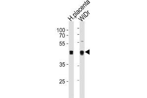 Western Blotting (WB) image for anti-SAP30 Binding Protein (SAP30BP) antibody (ABIN3004651) (SAP30BP 抗体)