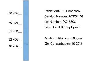 WB Suggested Anti-FHIT  Antibody Titration: 0. (FHIT 抗体  (Middle Region))