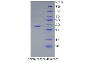 SDS-PAGE (SDS) image for Hemoglobin, alpha 1 (HBA1) (AA 1-142) protein (His tag) (ABIN2123834) (HBA1 Protein (AA 1-142) (His tag))