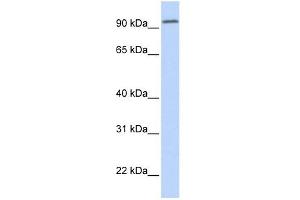 DPP6 antibody used at 1 ug/ml to detect target protein. (DPP6 抗体  (Middle Region))