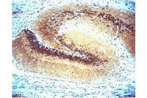 Immunohistochemistry (IHC) image for anti-Calcium/calmodulin-Dependent Protein Kinase II alpha (CAMK2A) (AA 448-460) antibody (ABIN968458) (CAMK2A 抗体  (AA 448-460))
