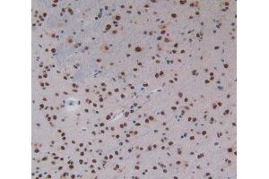 IHC-P analysis of Mouse Brain Tissue, with DAB staining. (KHDRBS1 抗体  (AA 156-381))