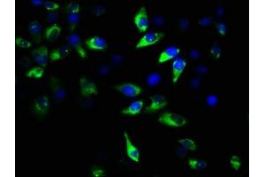 Immunofluorescence staining of Hela cells with ABIN7154715 at 1:167, counter-stained with DAPI. (GNAT2 抗体  (AA 2-139))