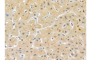 LSM1 Mouse Monoclonal Antibody at 1/100 staining human liver cancer and adjacent non-tumor tissue by IHC-P.