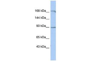 WB Suggested Anti-NARG1 Antibody Titration:  0. (NAA15 抗体  (Middle Region))