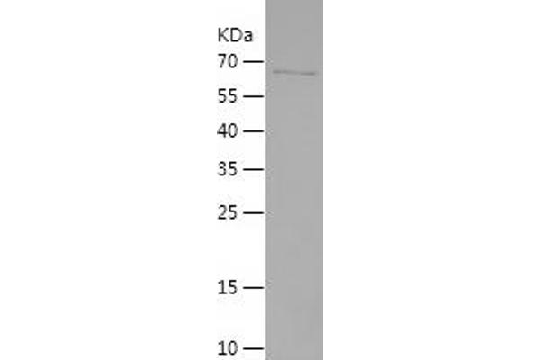 Androgen Receptor Protein (AR) (AA 551-919) (His-IF2DI Tag)