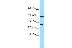 WB Suggested Anti-PDGFRL Antibody Titration: 1. (PDGFRL 抗体  (N-Term))