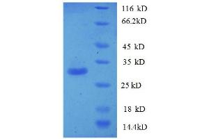 PTDSS1 Protein (AA 1-35, partial) (GST tag)