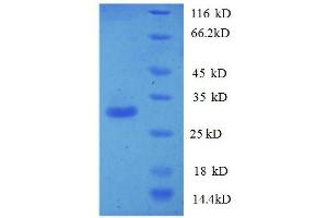 SDS-PAGE (SDS) image for phosphatidylserine Synthase 1 (PTDSS1) (AA 1-35), (partial) protein (GST tag) (ABIN1047515) (PTDSS1 Protein (AA 1-35, partial) (GST tag))