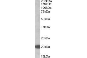 Western Blotting (WB) image for anti-GTPase NRas (NRAS) antibody (ABIN5872672) (GTPase NRas 抗体)