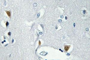 Immunohistochemistry (IHC) analyzes of p-Histone H2A. (H2AFX 抗体  (pSer139))