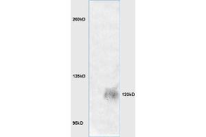 Lane 1: mouse brain lysates Lane 2: mouse embryo lysates probed with Anti LRIG1 Polyclonal Antibody, Unconjugated (ABIN735263) at 1:200 in 4 °C.