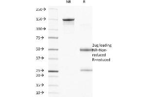 SDS-PAGE Analysis Purified CD104 Mouse Monoclonal Antibody (UMA9). (Integrin beta 4 抗体)