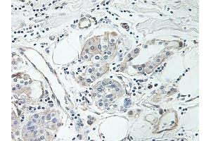 Image no. 4 for anti-Intercellular Adhesion Molecule 1 (ICAM1) antibody (ABIN465660) (ICAM1 抗体)