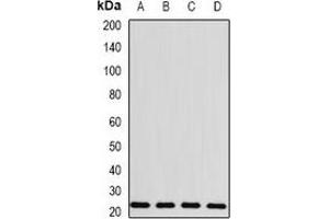 Western blot analysis of BLVRB expression in MCF7 (A), HepG2 (B), mouse spleen (C), rat liver (D) whole cell lysates. (BLVRB 抗体)