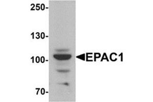 Western blot analysis of EPAC1 in rat skeletal muscle tissue lysate with EPAC1 Antibody  at 1 µg/ml. (RAPGEF3 抗体  (N-Term))