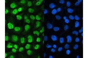 IF analysis of SAE2/UBA2 using anti-SAE2/UBA2 antibody (ABIN5692937). (UBA2 抗体  (AA 449-564))