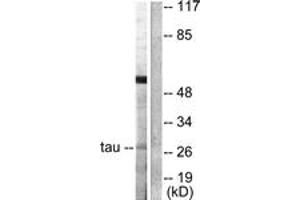 Western blot analysis of extracts from HeLa cells, using 14-3-3 thet/tau (Ab-232) Antibody. (14-3-3 theta 抗体  (AA 196-245))