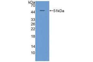Western blot analysis of recombinant Human KRT20. (KRT20 抗体  (AA 9-424))
