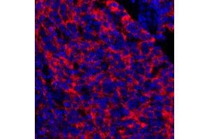 Immunofluorescence (IF) image for anti-5'-Nucleotidase, Ecto (CD73) (NT5E) (AA 27-552) antibody (ABIN7449540) (Recombinant CD73 抗体  (AA 27-552))
