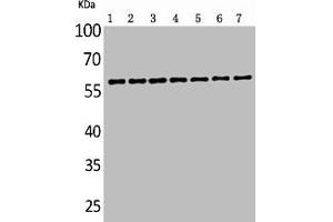 Western Blot analysis of customer's sample using ALPP/ALPPL2 Polyclonal Antibody. (PLAP 抗体  (N-Term))