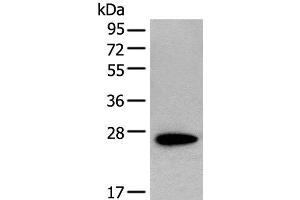 Western blot analysis of NIH/3T3 cell lysate using CD63 Polyclonal Antibody at dilution of 1:250 (CD63 抗体)
