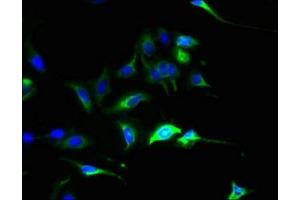 Immunofluorescent analysis of Hela cells using ABIN7147624 at dilution of 1:100 and Alexa Fluor 488-congugated AffiniPure Goat Anti-Rabbit IgG(H+L) (SLC44A4 抗体  (AA 56-229))