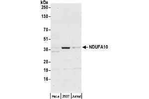 anti-NADH Dehydrogenase (Ubiquinone) 1 alpha Subcomplex, 10, 42kDa (NDUFA10) (AA 305-355) antibody