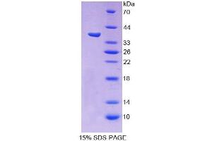 SDS-PAGE analysis of Human PCDHb15 Protein. (PCDHB15 蛋白)