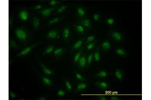 Immunofluorescence of monoclonal antibody to SKP1A on HeLa cell. (SKP1 抗体  (AA 53-160))