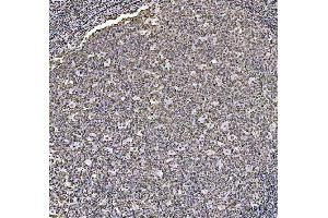 IHC analysis of HOXC4 using anti-HOXC4 antibody (ABIN7603059). (HOXC4 抗体  (Middle Region))