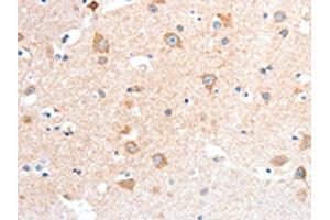 The image on the left is immunohistochemistry of paraffin-embedded Human brain tissue using ABIN7128440(ANXA8 Antibody) at dilution 1/25, on the right is treated with fusion protein. (Annexin VIII 抗体)