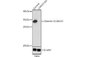 Western blot analysis of extracts from normal (control) and Galectin 3/Galectin 3/LG knockout (KO) HeLa cells, using Galectin 3/Galectin 3/LG antibody (ABIN6130437, ABIN6143158, ABIN6143159 and ABIN7101422) at 1:1000 dilution. (Galectin 3 抗体  (AA 1-250))