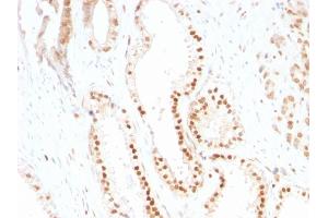 Immunohistochemistry (IHC) image for anti-Cyclin-Dependent Kinase Inhibitor 1B (p27, Kip1) (CDKN1B) antibody (ABIN6939044)