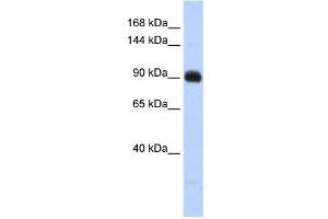 Matrilin 2 antibody used at 1 ug/ml to detect target protein. (MATN2 抗体  (Middle Region))