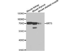 Western blot analysis of extracts of various cell lines, using KRT5 antibody. (Cytokeratin 5 抗体)