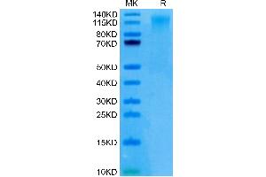Human CD96 (C110S) on Tris-Bis PAGE under reduced condition. (CD96 Protein (CD96) (Cys110Ser-Mutant) (His tag))