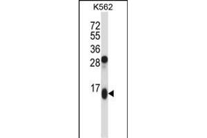 GUCA2A Antibody (Center) (ABIN657787 and ABIN2846761) western blot analysis in K562 cell line lysates (35 μg/lane). (GUCA2A 抗体  (AA 25-54))