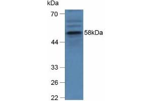 Detection of GBA in Human hepG2 Cells using Polyclonal Antibody to Glucocerebrosidase (GBA) (GBA 抗体  (AA 255-509))