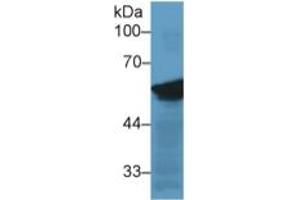 Mouse Capture antibody from the kit in WB with Positive Control: Sample Human Hela cell lysate. (Vimentin ELISA 试剂盒)