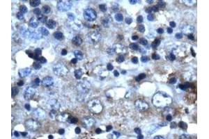 Image no. 1 for anti-Cyclin-Dependent Kinase 2 (CDK2) (C-Term) antibody (ABIN202994) (CDK2 抗体  (C-Term))