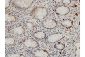 Immunostaining (ISt) image for anti-Tribbles Pseudokinase 2 (TRIB2) (AA 254-343) antibody (ABIN565396)