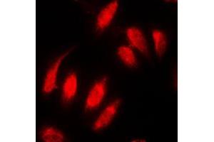 Immunofluorescent analysis of Topoisomerase 2 alpha staining in MDAMB231 cells.