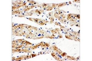 Immunohistochemistry (IHC) image for anti-Succinate Dehydrogenase Complex, Subunit B, Iron Sulfur (Ip) (SDHB) (AA 42-59) antibody (ABIN3032764)
