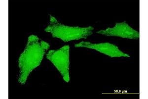 Immunofluorescence of monoclonal antibody to YBX1 on HeLa cell. (YBX1 抗体  (AA 51-139))