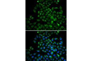 Immunofluorescence analysis of A549 cell using FABP4 antibody. (FABP4 抗体  (AA 1-132))