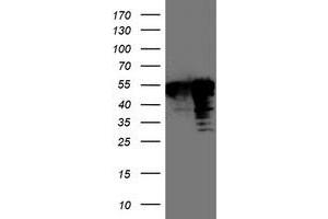 Western Blotting (WB) image for anti-T-Cell Acute Lymphocytic Leukemia 1 (TAL1) antibody (ABIN1501294)