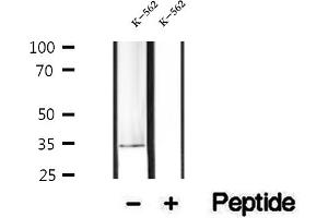 Western blot analysis of extracts of K-562 cells, using PDHB antibody. (PDHB 抗体  (N-Term))