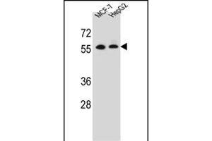 MGAT2 Antibody  (ABIN389038 and ABIN2839252) western blot analysis in MCF-7?